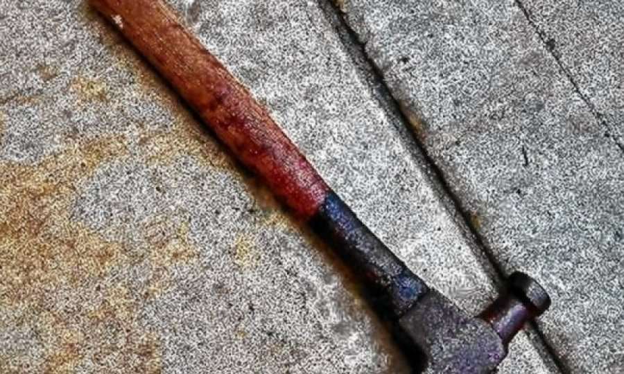 An Albanian dies in Tetovo, he was hit by his wife with a hammer
