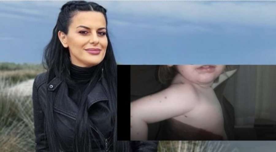 Big Mama ia siguron udhëtimin për në Turqi vajzës nga Skenderaj