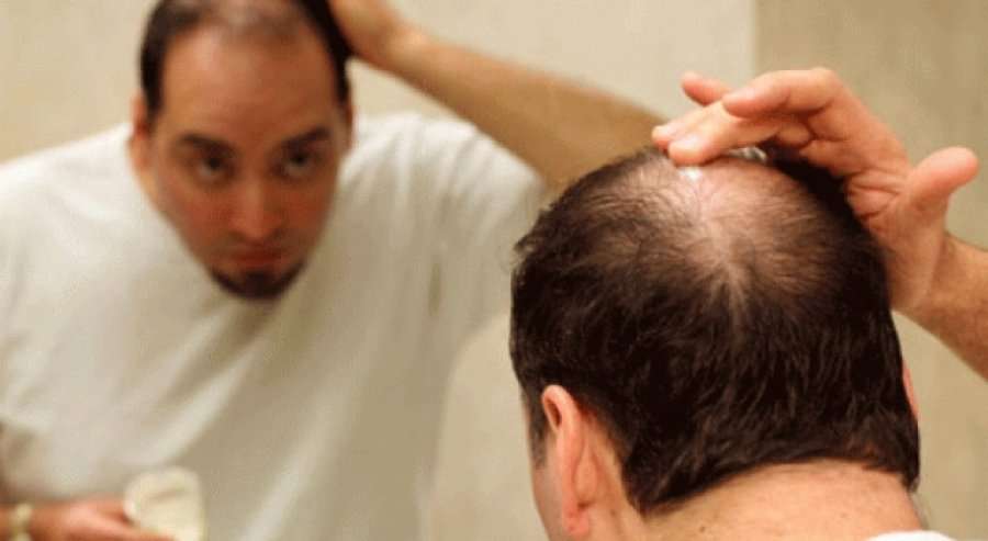 Probleme me rënien e flokëve? Kjo është vitamina që duhet ta merrni patjetër