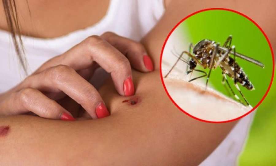Si të parandaloni pickimin nga mushkonjat, metodat më të forta natyrale