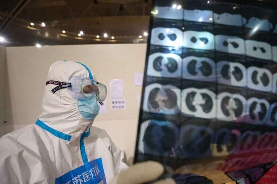 Wuhan, vazhdojnë të kenë probleme pacientët e parë me COVID-19