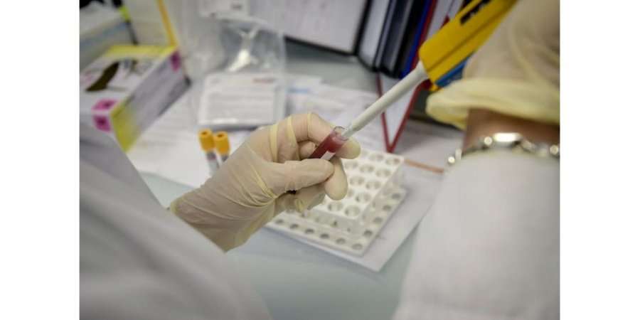 Organizata “Konsumatori” reagon ndaj çmimeve të larta për testet serologjike të laboratorëve privatë