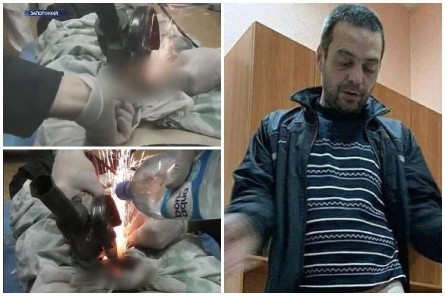 Mësoi se e kishte tradhtuar, gruaja e zemëruar i vendos bullon metalik burrit në organin gjenital