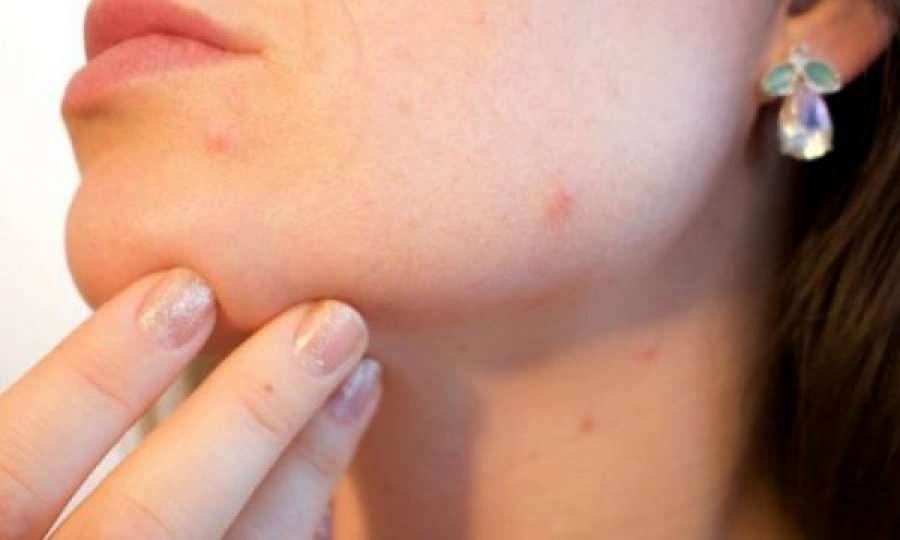 Ndodhet në shtëpitë e të gjithëve, ilaçi magjik për lëkurë të pastër, katër mënyra si ta përdorni