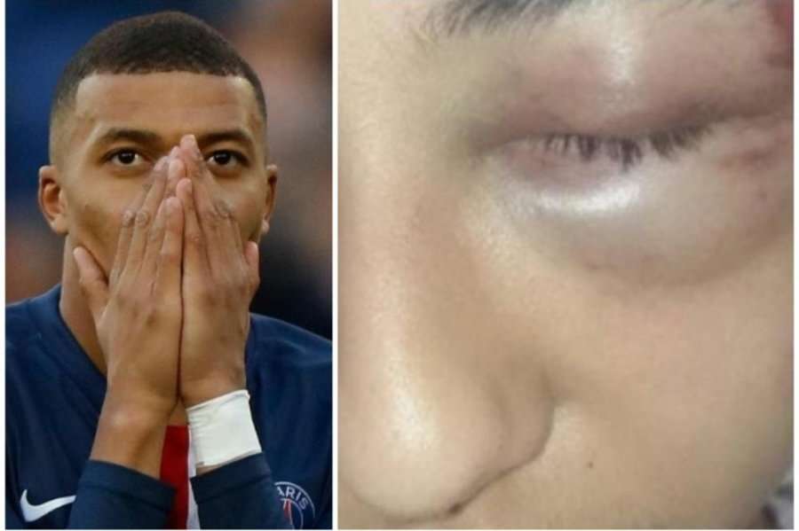 Protestat në Francë, Mbappe i del në krah djaloshit serb: Drejtësi për Gabrielin