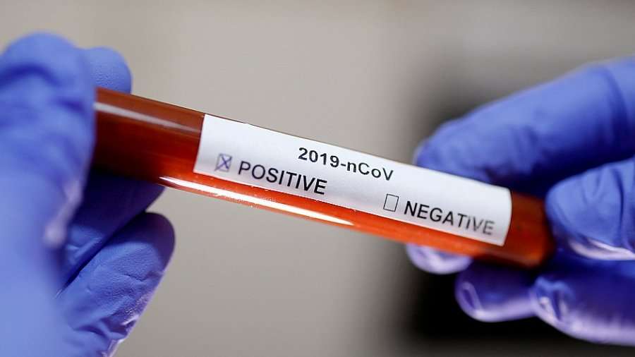 Një tjetër fytyrë publike del pozitiv me koronavirus