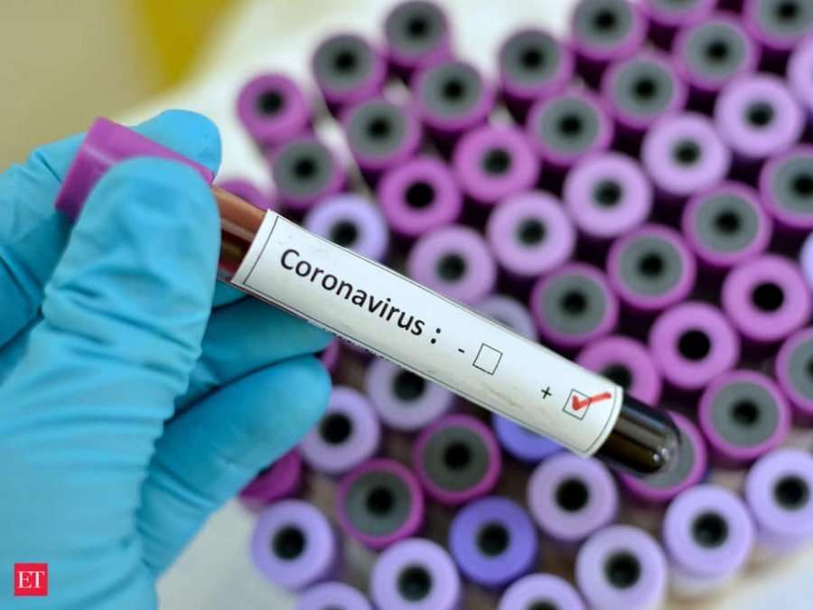 Shkon në nëntë numri i viktimave nga koronavirusi në Maqedoninë e Veriut