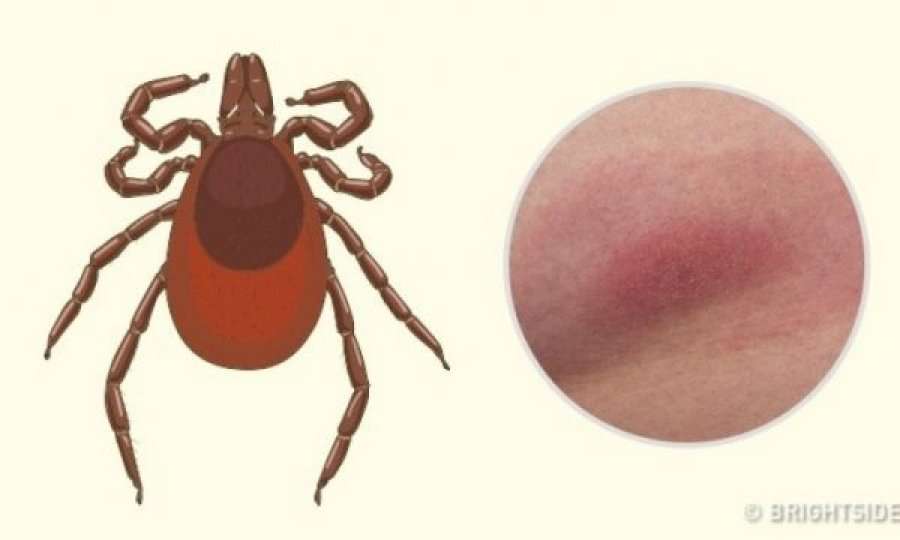 Pickime insektesh që kushdo duhet të jetë në gjendje t’i identifikojë