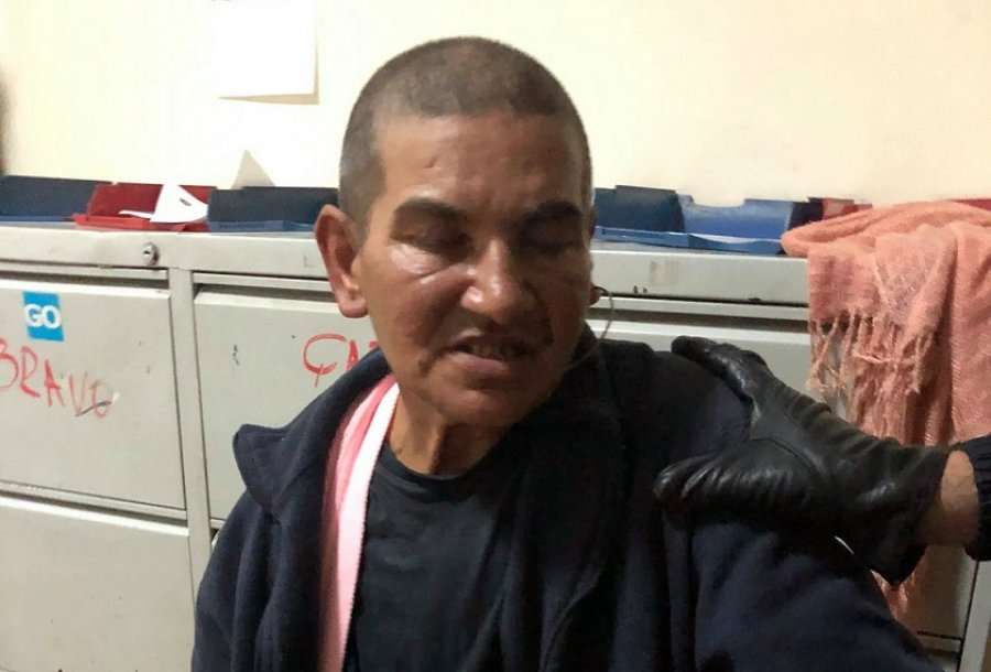 Goditet për vdekje këmbësorja në Prizren, policia kërkon ndihmë për ta identifikuar