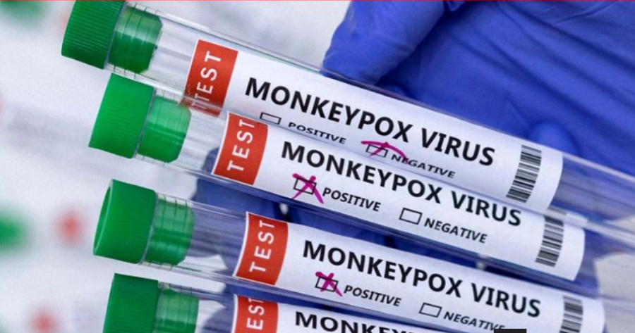 Lia e majmunit, EMA: Nuk është një urgjencë shëndetësore, vetëm masë paraprake