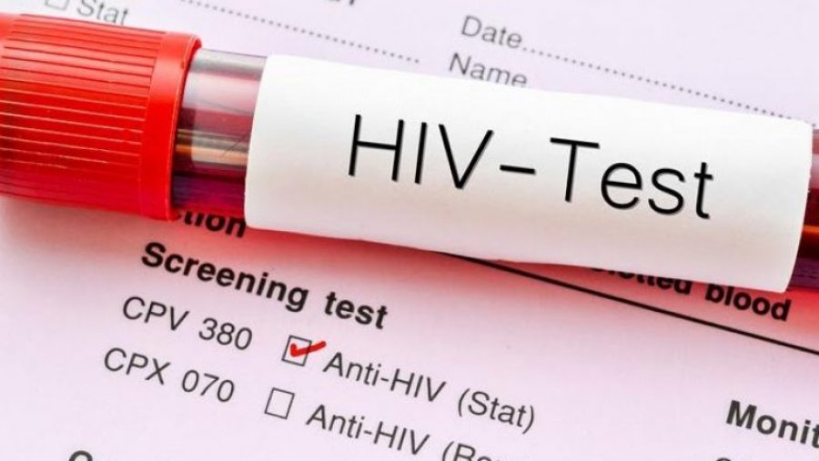 Në Maqedoni me HIV jetojnë 687 persona, shoqatat kërkojnë më shumë mjete për terapi