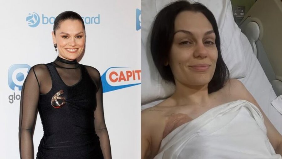 Jessie J do të rikthehet në muzikë, pasi anuloi datat e turneut për shkak të operacionit të dytë
