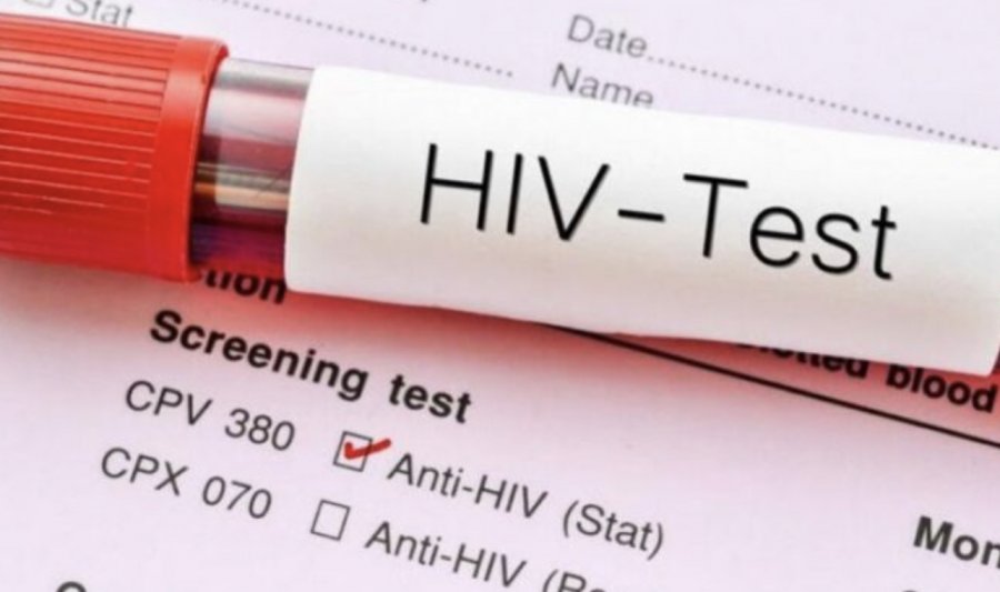 Gjashtë të vdekur këtë vit në Kosovë si pasojë e HIV/AIDS-it, 31 raste të reja