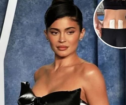 Kylie Jenner zbuloi se iu nënshtrua terapisë me qeliza staminale për të lehtësuar dhimbjet e shpinës pas lindjes
