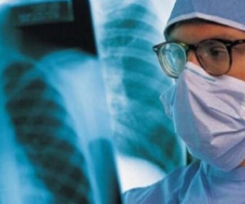 Rastet e tuberkulozit në rritje në Zvicër