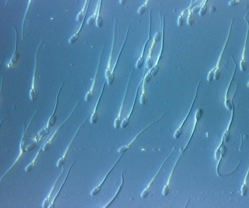 Si u shpërnda në mbarë Evropën një gjen kanceri i rrallë?