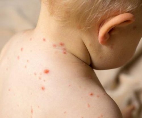 18 raste me fruth në Shqipëri, përgjatë vitit 2025