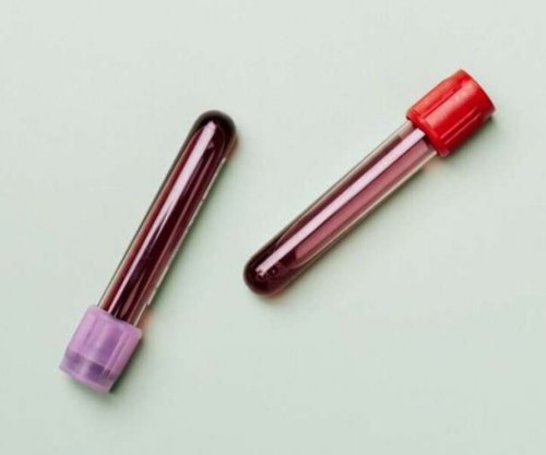 Gjaku artificial hyn në fazë testimi klinik