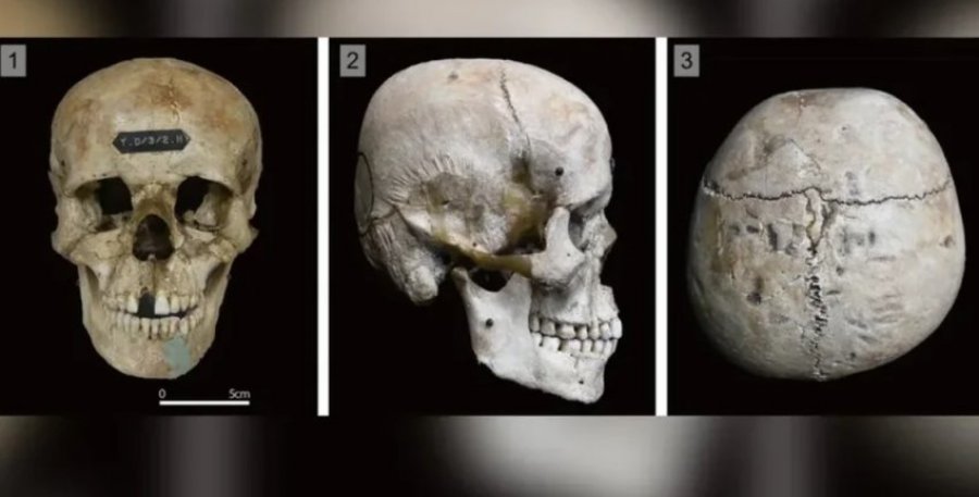 Misteri i kafkave të modifikuara të njeriut në Japoninë e lashtë, çfarë thonë studiuesit?