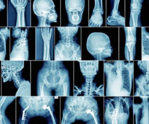 Ja si ta kuptoni se vuani nga artriti