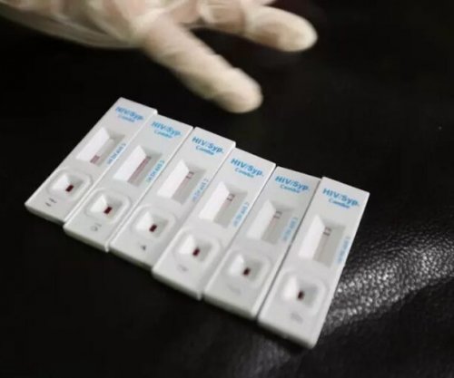 OBSH: Gjysma e diagnozave të HIV në Evropë zbulohen shumë vonë