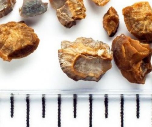 Kështu e kuptoni nëse keni gurë në veshkë