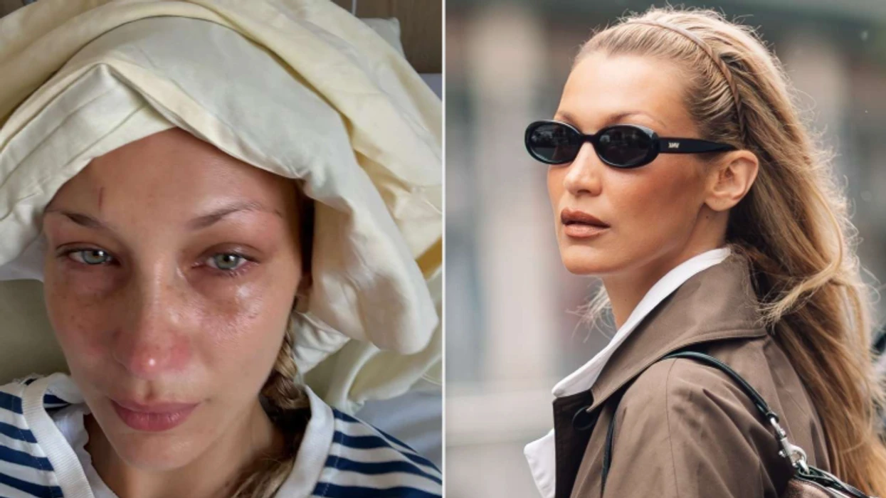 Bella Hadid flet hapur për betejën e gjatë me depresionin: E nisja çdo ditë me lot