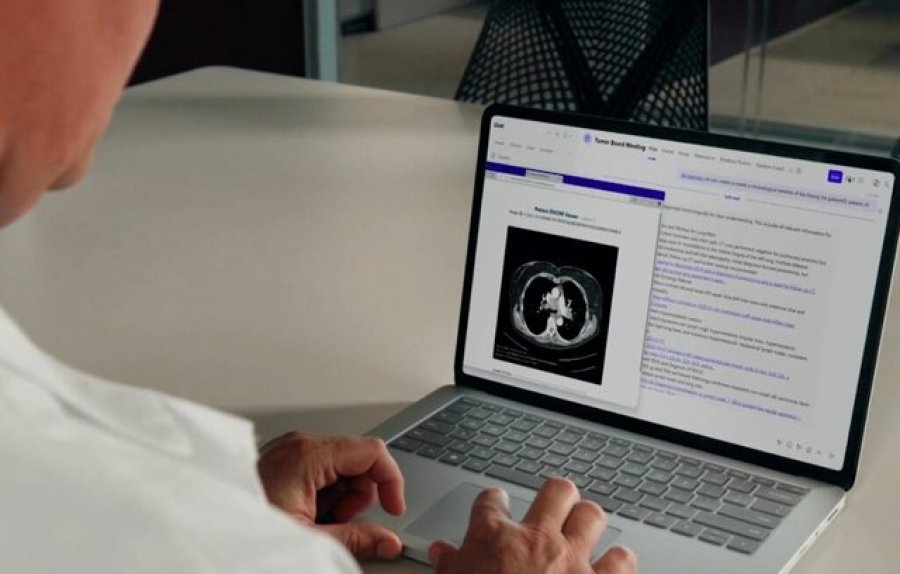 Inteligjenca artificiale e Microsoft tejkalon mjekët