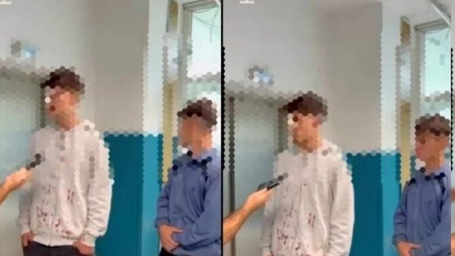 Sulmi ndaj nxënësve shqiptarë në Tetovë, Policia nis hetimet