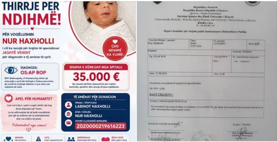 Familja Haxholli kërkon ndihmë për trajtimin e vogëlushit Nur, nevojiten 35 mijë euro