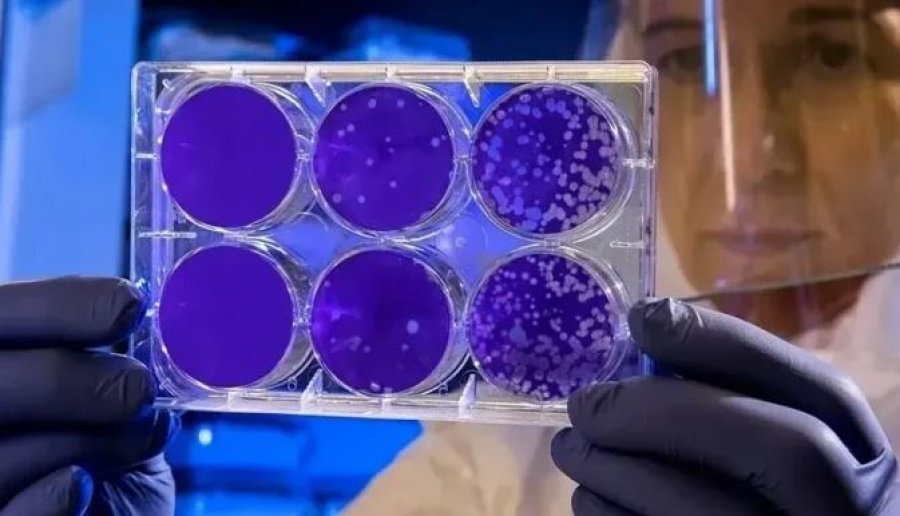 Shkencëtarët përdorin për herë të parë IA-në për të krijuar viruse të reja