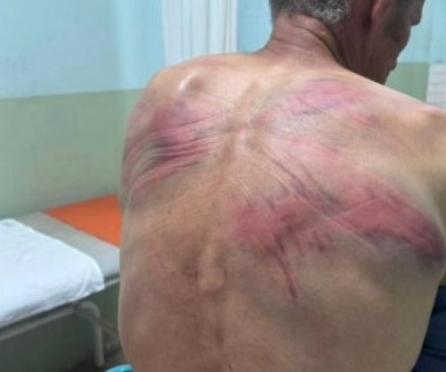 IPK-ja nis hetimet pas pretendimeve të një serbi se u rrah nga Policia në Zubin Potok