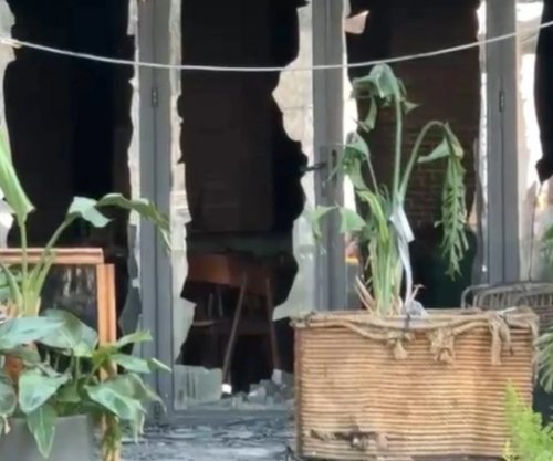 Zjarri në hotelin në Vlorë, 25-vjeçarja që pësoi 85% djegie të trupit dërgohet për trajtim në Turqi