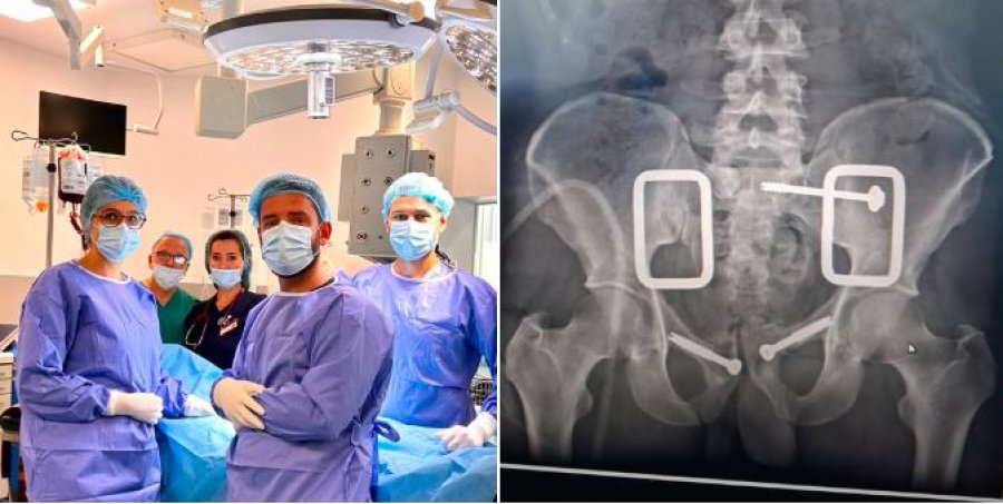 QKUK-ja realizon me sukses ndërhyrje të avancuar për frakturë komplekse të pelvikut