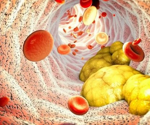 Kolesteroli i lartë shoqërohet me jetëgjatësi më të madhe