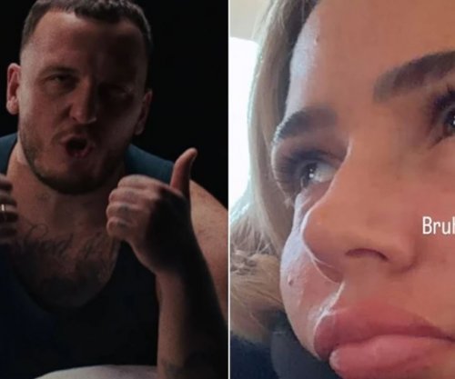 Reagimi i Loredanës pas këngës së Mozzik 