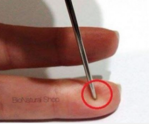 Parainfarkti, ja si t’i shpëtoni jetën dikujt