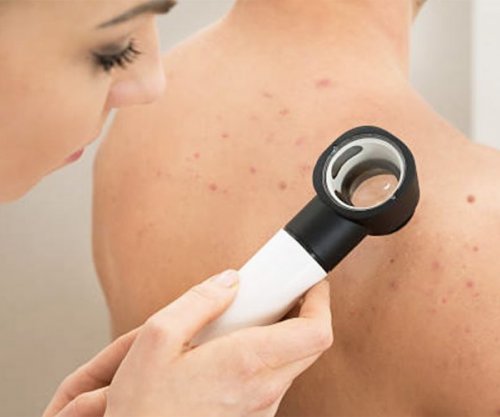 Pesë shenjat e çrregullimeve hormonale