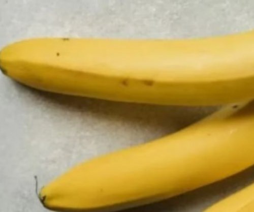 Sa të shëndetshme janë bananet?