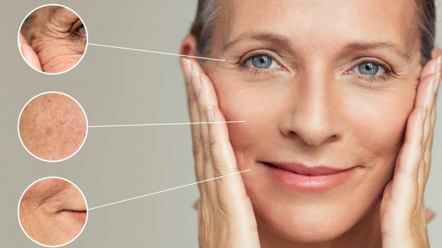 A do të thotë që lëkura me yndyrë do të më sjellë më pak rrudha?