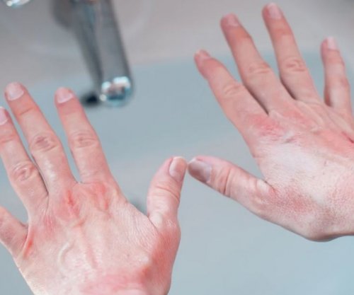 Duart e thata: Një truk menjëherë pas larjes parandalon tharjen