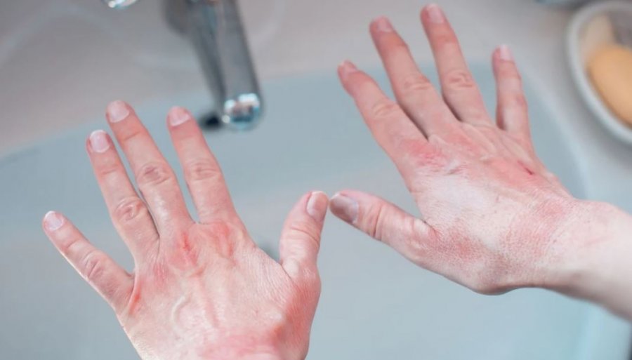 Duart e thata: Një truk menjëherë pas larjes parandalon tharjen