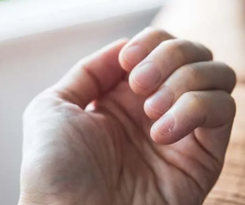 Pesë shenja që jua japin duart kur keni problem me tiroiden