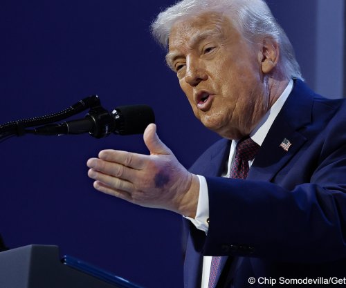 Dora e mavijosur e Trumpit ndez spekulime për shëndetin e presidentit amerikan