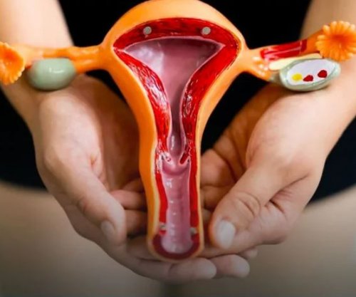 Endometrioza dhe rritja e rrezikut për sëmundje kardiovaskulare