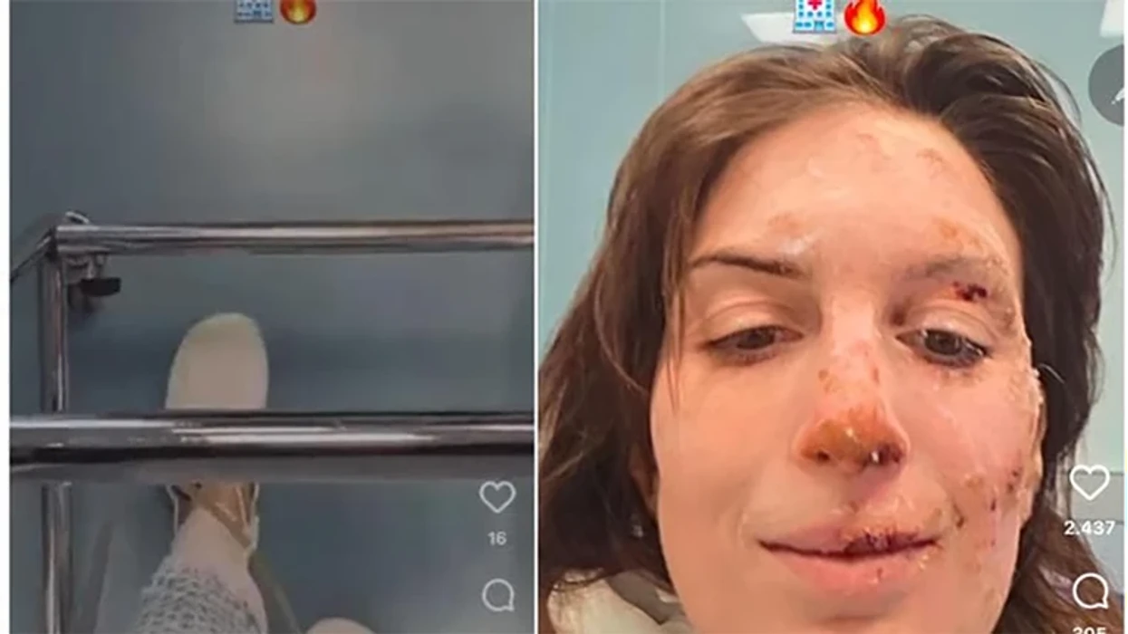 Rrëfimi i gruas që i mbijetoi zjarrit në Zvicër: Nuk e di si shpëtova