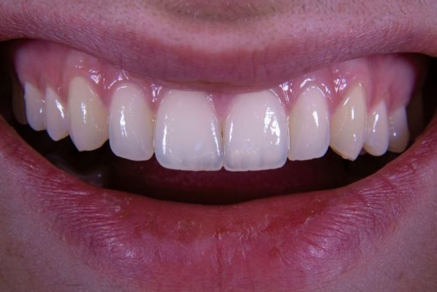 Jo zemra, jo truri; dhëmbët zbulojnë sekretin e jetëgjatësisë