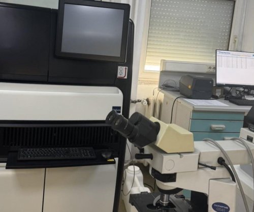 IKSHPK-ja fillon testimin e avancuar për zbulimin e tuberkulozit