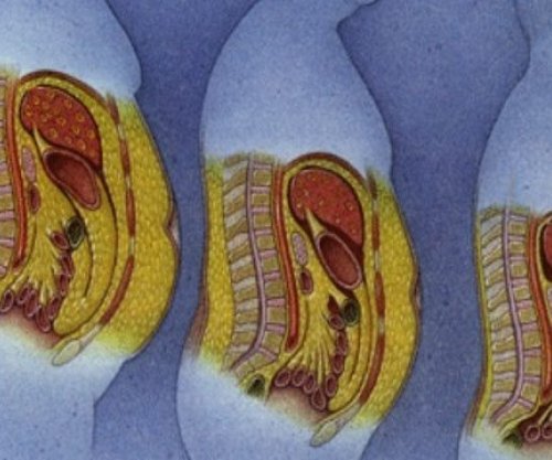 Çfarë ndodh me dhjamin kur dobësoheni?