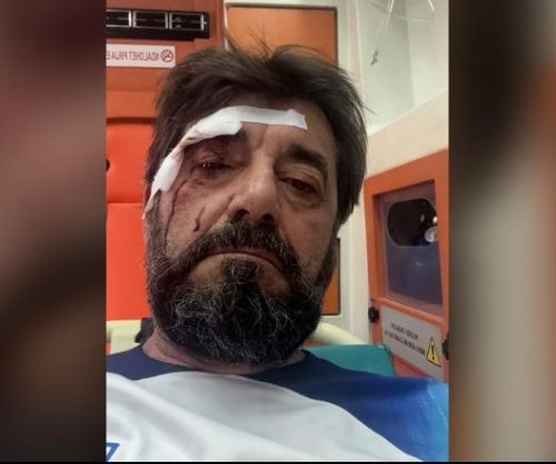 Sulmohet brutalisht në Tiranë analisti Ilir Demaliaj